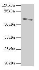 Western blot  | All lanes: SLC1A6 antibody at 2µg/ml + A375 whole cell lysate  | Secondary  | Goat polyclonal to rabbit IgG at 1/10000 dilution  | Predicted band size: 62, 35 kDa  | Observed band size: 62 kDaRabbit anti-Human SLC1A6 Polyclonal Antibody