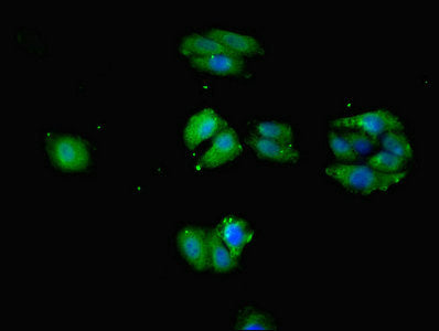 Immunofluorescent analysis of HepG2 cells using SLC1A7 Antibody at dilution of 1:100 and Alexa Fluor 488-congugated AffiniPure Goat Anti-Rabbit IgG(H+L)Rabbit anti-Human SLC1A7 Polyclonal Antibody