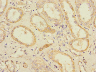 Immunohistochemistry of paraffin-embedded human kidney tissue using SLC1A7 Antibody at dilution of 1:100Rabbit anti-Human SLC1A7 Polyclonal Antibody