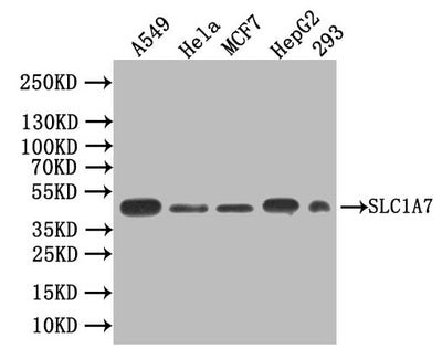 Western blot | All lanes: SLC1A7antibody IgG at 1.55μg/ml + Rat heart tissue | Secondary | Goat polyclonal to rabbit IgG at 1/10000 dilution | Predicted band size: 61, 18 kDa | Observed band size: 61 kDaRabbit anti-Human SLC1A7 Polyclonal Antibody