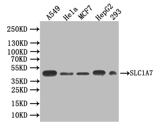 Western blot | All lanes: SLC1A7antibody IgG at 1.55μg/ml + Rat heart tissue | Secondary | Goat polyclonal to rabbit IgG at 1/10000 dilution | Predicted band size: 61, 18 kDa | Observed band size: 61 kDaRabbit anti-Human SLC1A7 Polyclonal Antibody