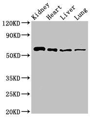 Western Blot | Positive WB detected in: Mouse kidney tissue, Rat heart tissue, Rat liver tissue, Rat lung tissue | All lanes: SLC22A2 antibody at 2.7μg/ml | Secondary | Goat polyclonal to rabbit IgG at 1/50000 dilution | Predicted band size: 63, 55, 27 kDa | Observed band size: 63 kDaRabbit anti-Human SLC22A2 Polyclonal Antibody