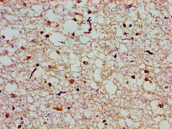 Immunohistochemistry of paraffin-embedded human brain tissue using SLC25A12 Antibody at dilution of 1:100Rabbit anti-Human SLC25A12 Polyclonal Antibody