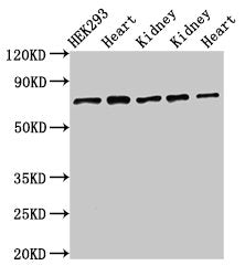 Western Blot  | Positive WB detected in: HEK293 whole cell lysate, Rat heart tissue, Rat kidney tissue, Mouse kidney tissue, Mouse heart tissue  | All lanes: SLC25A12 antibody at 3µg/ml  | Secondary  | Goat polyclonal to rabbit IgG at 1/50000 dilution  | Predicted band size: 75, 63 kDa  | Observed band size: 75 kDaRabbit anti-Human SLC25A12 Polyclonal Antibody