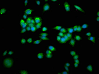 Immunofluorescence staining of PC-3 cells with SLC25A4 Antibody at 1:266, counter-stained with DAPI. The cells were fixed in 4% formaldehyde, permeabilized using 0.2% Triton X-100 and blocked in 10% normal Goat Serum. The cells were then incubated with the antibody overnight at 4°C. The secondary antibody was Alexa Fluor 488-congugated AffiniPure Goat Anti-Rabbit IgG(H+L).Rabbit anti-Human SLC25A4 Polyclonal Antibody
