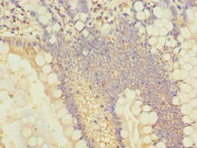 Immunohistochemistry of paraffin-embedded human small intestine tissue using the antibody at dilution of 1:100Rabbit anti-Human SLC25A4 Polyclonal Antibody