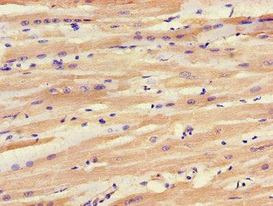 IHC image of SLC25A6 Antibody diluted at 1:1200 and staining in paraffin-embedded human heart tissue performed on a Leica BondTM system. After dewaxing and hydration, antigen retrieval was mediated by high pressure in a citrate buffer (pH 6.0). Section was blocked with 10% normal goat serum 30min at RT. Then primary antibody (1% BSA) was incubated at 4°C overnight. The primary is detected by a biotinylated secondary antibody and visualized using an HRP conjugated SP system.Rabbit anti-Human SLC25A6 Polyclonal Antibody