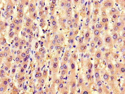 IHC image of SLC25A6 Antibody diluted at 1:1200 and staining in paraffin-embedded human liver tissue performed on a Leica BondTM system. After dewaxing and hydration, antigen retrieval was mediated by high pressure in a citrate buffer (pH 6.0). Section was blocked with 10% normal goat serum 30min at RT. Then primary antibody (1% BSA) was incubated at 4°C overnight. The primary is detected by a biotinylated secondary antibody and visualized using an HRP conjugated SP system.Rabbit anti-Human SLC25A6 Polyclonal Antibody