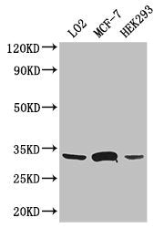 Western Blot | Positive WB detected in: LO2 whole cell lysate, MCF-7 whole cell lysate, HEK293 whole cell lysate | All lanes: SLC25A6 antibody at 3μg/ml | Secondary | Goat polyclonal to rabbit IgG at 1/50000 dilution | Predicted band size: 33 kDa | Observed band size: 33 kDaRabbit anti-Human SLC25A6 Polyclonal Antibody