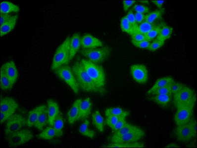 Immunofluorescence staining of HepG2 cells with SLC26A2 Antibody at 1:100, counter-stained with DAPI. The cells were fixed in 4% formaldehyde, permeabilized using 0.2% Triton X-100 and blocked in 10% normal Goat Serum. The cells were then incubated with the antibody overnight at 4°C. The secondary antibody was Alexa Fluor 488-congugated AffiniPure Goat Anti-Rabbit IgG(H+L).Rabbit anti-Human SLC26A2 Polyclonal Antibody