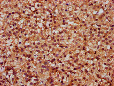 IHC image of the antibody diluted at 1:300 and staining in paraffin-embedded human adrenal gland tissue performed on a Leica BondTM system. After dewaxing and hydration, antigen retrieval was mediated by high pressure in a citrate buffer (pH 6.0). Section was blocked with 10% normal goat serum 30min at RT. Then primary antibody (1% BSA) was incubated at 4°C overnight. The primary is detected by a biotinylated secondary antibody and visualized using an HRP conjugated SP system.Rabbit anti-Human SLC26A2 Polyclonal Antibody