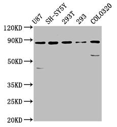 Western Blot  | Positive WB detected in: U87 whole cell lysate, SH-SY5Y whole cell lysate, 293T whole cell lysate, 293 whole cell lysate, Colo320 whole cell lysate  | All lanes: SLC26A4 antibody at 5.7µg/ml  | Secondary  | Goat polyclonal to rabbit IgG at 1/50000 dilution  | Predicted band size: 86, 40 kDa  | Observed band size: 86 kDaRabbit anti-Human SLC26A4 Polyclonal Antibody