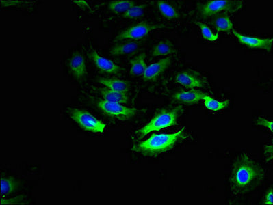 Immunofluorescent analysis of Hela cells using SLC28A1 Antibody at dilution of 1:100 and Alexa Fluor 488-congugated AffiniPure Goat Anti-Rabbit IgG(H+L)Rabbit anti-Human SLC28A1 Polyclonal Antibody