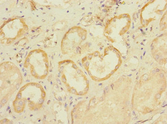 Immunohistochemistry of paraffin-embedded human kidney tissue using the antibody at dilution of 1:100Rabbit anti-Human SLC28A1 Polyclonal Antibody