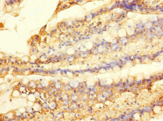 Immunohistochemistry of paraffin-embedded human small intestine tissue using SLC28A1 Antibody at dilution of 1:100Rabbit anti-Human SLC28A1 Polyclonal Antibody
