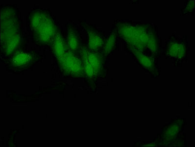 Immunofluorescent analysis of Hela cells using SLC2A4 Antibody at dilution of 1:100 and Alexa Fluor 488-congugated AffiniPure Goat Anti-Rabbit IgG(H+L)Rabbit anti-Human SLC2A4 Polyclonal Antibody