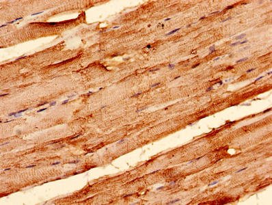 Immunohistochemistry analysis of human skeletal muscle tissue using SLC2A4 Antibody at dilution of 1:100Rabbit anti-Human SLC2A4 Polyclonal Antibody
