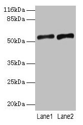 Western blot  | All lanes: SLC2A4 antibody at 2µg/ml  | Lane 1: Mouse heart tissue  | Lane 2: Hela whole cell lysate  | Secondary  | Goat polyclonal to rabbit IgG at 1/10000 dilution  | Predicted band size: 55, 44 kDa  | Observed band size: 55 kDaRabbit anti-Human SLC2A4 Polyclonal Antibody
