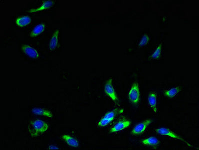 Immunofluorescent analysis of Hela cells using SLC31A2 Antibody at dilution of 1:100 and Alexa Fluor 488-congugated AffiniPure Goat Anti-Rabbit IgG(H+L)Rabbit anti-Human SLC31A2 Polyclonal Antibody