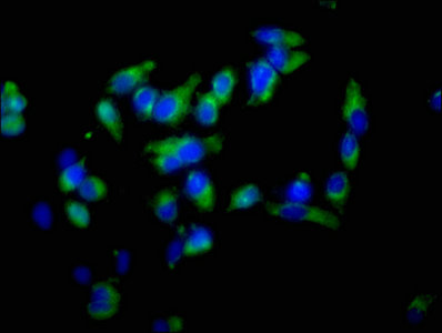 Immunofluorescence staining of Hela cells with EZR Antibody at 1:100, counter-stained with DAPI. The cells were fixed in 4% formaldehyde, permeabilized using 0.2% Triton X-100 and blocked in 10% normal Goat Serum. The cells were then incubated with the antibody overnight at 4°C. The secondary antibody was Alexa Fluor 488-congugated AffiniPure Goat Anti-Rabbit IgG(H+L).Rabbit anti-Human EZR Polyclonal Antibody