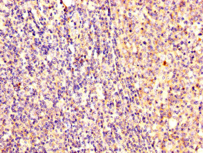 IHC image of the antibody diluted at 1:300 and staining in paraffin-embedded human tonsil tissue performed on a Leica BondTM system. After dewaxing and hydration, antigen retrieval was mediated by high pressure in a citrate buffer (pH 6.0). Section was blocked with 10% normal goat serum 30min at RT. Then primary antibody (1% BSA) was incubated at 4°C overnight. The primary is detected by a biotinylated secondary antibody and visualized using an HRP conjugated SP system.Rabbit anti-Human EZR Polyclonal Antibody