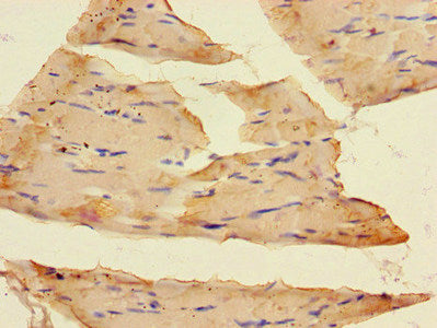 Immunohistochemistry of paraffin-embedded human skeletal muscle tissue using SLC37A1 Antibody at dilution of 1:100Rabbit anti-Human SLC37A1 Polyclonal Antibody