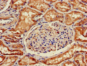 Immunohistochemistry of paraffin-embedded human kidney tissue using SLC5A1 Antibody at dilution of 1:100Rabbit anti-Human SLC5A1 Polyclonal Antibody