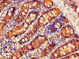 Immunohistochemistry of paraffin-embedded human small intestine tissue using SLC5A1 Antibody at dilution of 1:100Rabbit anti-Human SLC5A1 Polyclonal Antibody