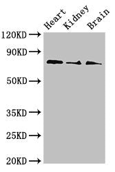 Western Blot | Positive WB detected in: Mouse heart tissue, Mouse kidney tissue, Mouse brain tissue | All lanes: SLC5A1 antibody at 4μg/ml | Secondary | Goat polyclonal to rabbit IgG at 1/50000 dilution | Predicted band size: 74, 61 kDa | Observed band size: 74 kDaRabbit anti-Human SLC5A1 Polyclonal Antibody