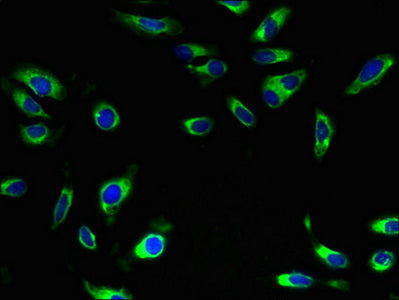 Immunofluorescent analysis of Hela cells using the antibody at dilution of 1:100 and Alexa Fluor 488-congugated AffiniPure Goat Anti-Rabbit IgG(H+L)Rabbit anti-Human SLC5A10 Polyclonal Antibody
