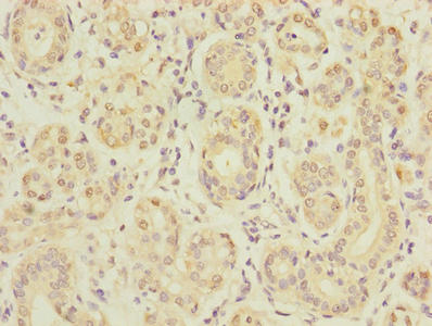 Immunohistochemistry of paraffin-embedded human salivary gland tissue using SLC5A10 Antibody at dilution of 1:100Rabbit anti-Human SLC5A10 Polyclonal Antibody