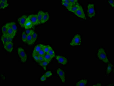 Immunofluorescence staining of HepG2 cells with SLC7A1 Antibody at 1:166, counter-stained with DAPI. The cells were fixed in 4% formaldehyde, permeabilized using 0.2% Triton X-100 and blocked in 10% normal Goat Serum. The cells were then incubated with the antibody overnight at 4°C. The secondary antibody was Alexa Fluor 488-congugated AffiniPure Goat Anti-Rabbit IgG(H+L).Rabbit anti-Human SLC7A1 Polyclonal Antibody