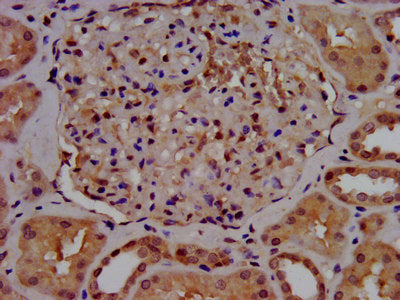 IHC image of SLC7A1 Antibody diluted at 1:500 and staining in paraffin-embedded human kidney tissue performed on a Leica BondTM system. After dewaxing and hydration, antigen retrieval was mediated by high pressure in a citrate buffer (pH 6.0). Section was blocked with 10% normal goat serum 30min at RT. Then primary antibody (1% BSA) was incubated at 4°C overnight. The primary is detected by a biotinylated secondary antibody and visualized using an HRP conjugated SP system.Rabbit anti-Human SLC7A1 Polyclonal Antibody