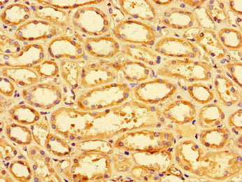 Immunohistochemistry of paraffin-embedded human kidney tissue using SLC9A1 Antibody at dilution of 1:100Rabbit anti-Human SLC9A1 Polyclonal Antibody