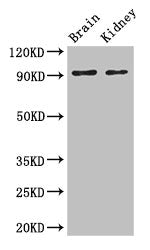 Western Blot | Positive WB detected in: Mouse brain tissue, Mouse kidney tissue | All lanes: SLC9A1 antibody at 3μg/ml | Secondary | Goat polyclonal to rabbit IgG at 1/50000 dilution | Predicted band size: 91, 62 kDa | Observed band size: 91 kDaRabbit anti-Human SLC9A1 Polyclonal Antibody