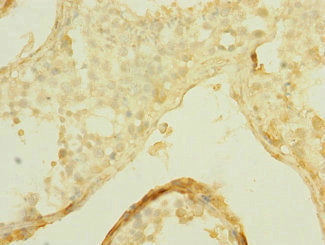 Immunohistochemistry of paraffin-embedded human testis tissue using SLCO2B1 Antibody at dilution of 1:100Rabbit anti-Human SLCO2B1 Polyclonal Antibody