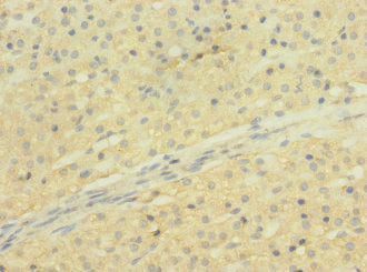 Immunohistochemistry of paraffin-embedded human adrenal gland tissue using SLCO2B1 Antibody at dilution of 1:100Rabbit anti-Human SLCO2B1 Polyclonal Antibody