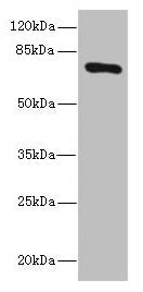 Western blot  | All lanes: SLCO2B1 antibody at 1.5µg/ml + HepG2 whole cell lysate  | Secondary  | Goat polyclonal to rabbit IgG at 1/10000 dilution  | Predicted band size: 77, 53, 75, 62 kDa  | Observed band size: 77 kDaRabbit anti-Human SLCO2B1 Polyclonal Antibody