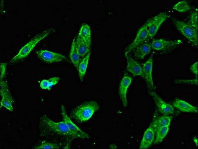 Immunofluorescent analysis of Hela cells using SLFN11 Antibody at dilution of 1:100 and Alexa Fluor 488-congugated AffiniPure Goat Anti-Rabbit IgG(H+L)Rabbit anti-Human SLFN11 Polyclonal Antibody