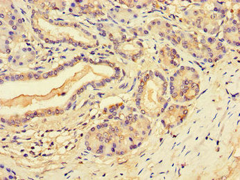 Immunohistochemistry of paraffin-embedded human pancreatic tissue using SLFN11 Antibody at dilution of 1:100Rabbit anti-Human SLFN11 Polyclonal Antibody