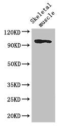 Western Blot | Positive WB detected in: Mouse skeletal muscle tissue | All lanes: SLFN11 antibody at 2.8μg/ml | Secondary | Goat polyclonal to rabbit IgG at 1/50000 dilution | Predicted band size: 103 kDa | Observed band size: 103 kDaRabbit anti-Human SLFN11 Polyclonal Antibody