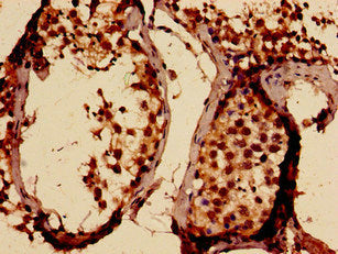 Immunohistochemistry analysis of human testis tissue using SLITRK5 Antibody at dilution of 1:100