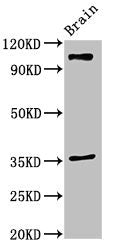 Western Blot | Positive WB detected in: Mouse brain tissue | All lanes: SLITRK5 antibody at 2μg/ml | Secondary | Goat polyclonal to rabbit IgG at 1/50000 dilution | Predicted band size: 108, 80 kDa | Observed band size: 108 kDa