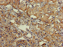 Immunohistochemistry of paraffin-embedded human adrenal gland tissue using SLU7 Antibody at dilution of 1:100Rabbit anti-Human SLU7 Polyclonal Antibody