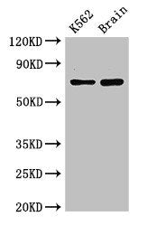 Western Blot | Positive WB detected in: K562 whole cell lysate, Mouse brain tissue | All lanes: SLU7 antibody at 3μg/ml | Secondary | Goat polyclonal to rabbit IgG at 1/50000 dilution | Predicted band size: 69 kDa | Observed band size: 69 kDaRabbit anti-Human SLU7 Polyclonal Antibody
