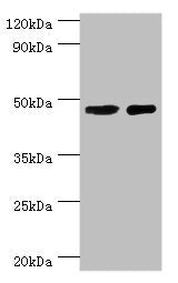 Western blot | All lanes: SMAD3 antibody at 8μg/ml | Lane 1: Jurkat whole cell lysate | Lane 2: A431 whole cell lysate | Secondary | Goat polyclonal to rabbit IgG at 1/10000 dilution | Predicted band size: 49, 44, 36, 26 kDa | Observed band size: 49 kDaRabbit anti-Human SMAD3 Polyclonal Antibody