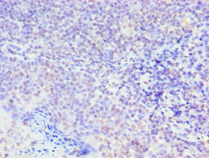 Immunohistochemistry of paraffin-embedded human tonsil tissue using the antibody at dilution of 1:100Rabbit anti-Human SMAD9 Polyclonal Antibody
