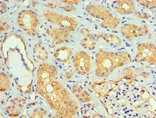 Immunohistochemistry of paraffin-embedded human kidney tissue using SMAD9 Antibody at dilution of 1:100Rabbit anti-Human SMAD9 Polyclonal Antibody