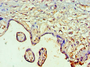 Immunohistochemistry of paraffin-embedded human placenta tissue using SMAD9 Antibody at dilution of 1:100Rabbit anti-Human SMAD9 Polyclonal Antibody