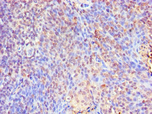 Immunohistochemistry of paraffin-embedded human tonsil tissue using SMAD9 Antibody at dilution of 1:100Rabbit anti-Human SMAD9 Polyclonal Antibody